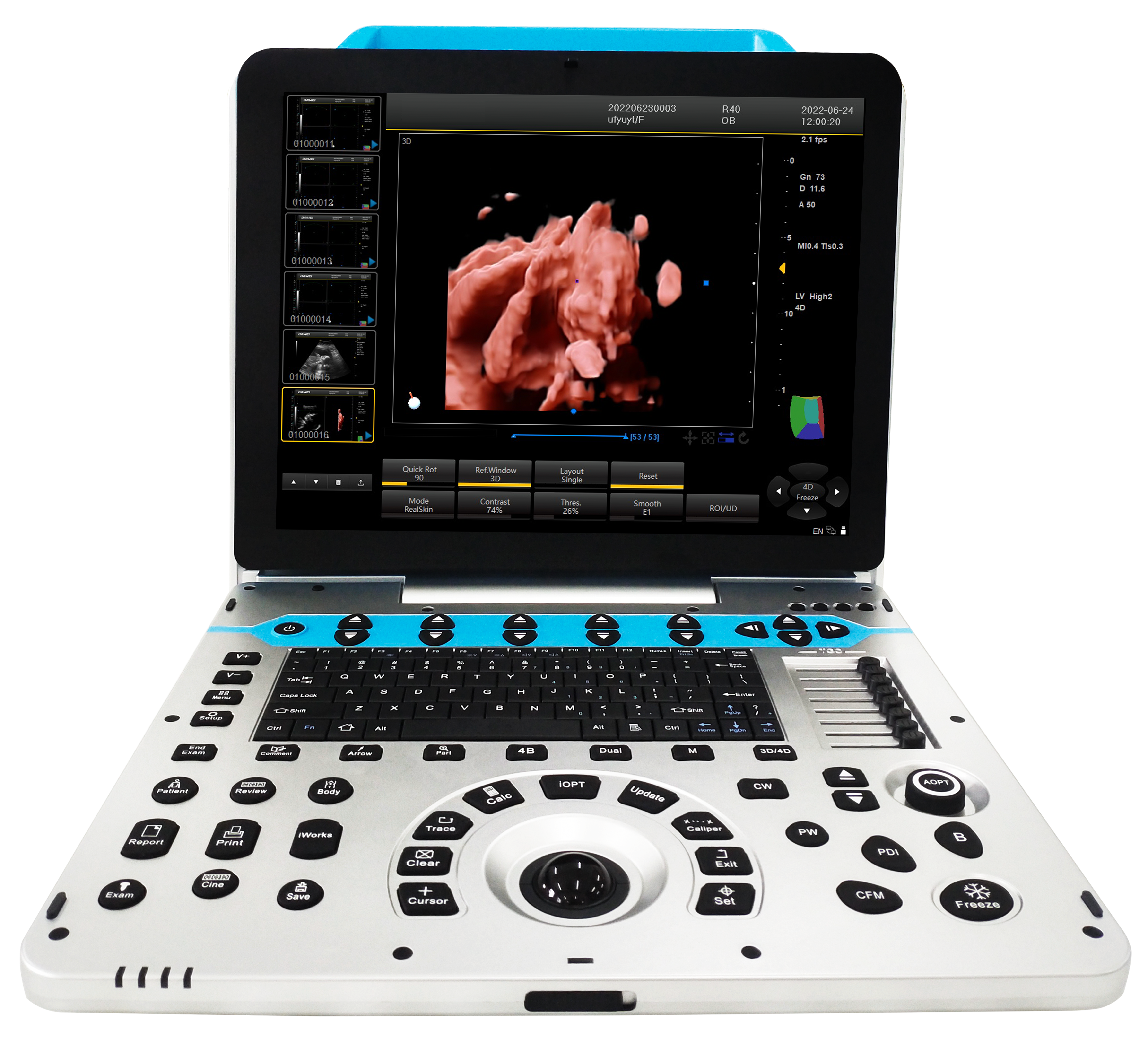 CG-P31 Portable Color Ultrasound System