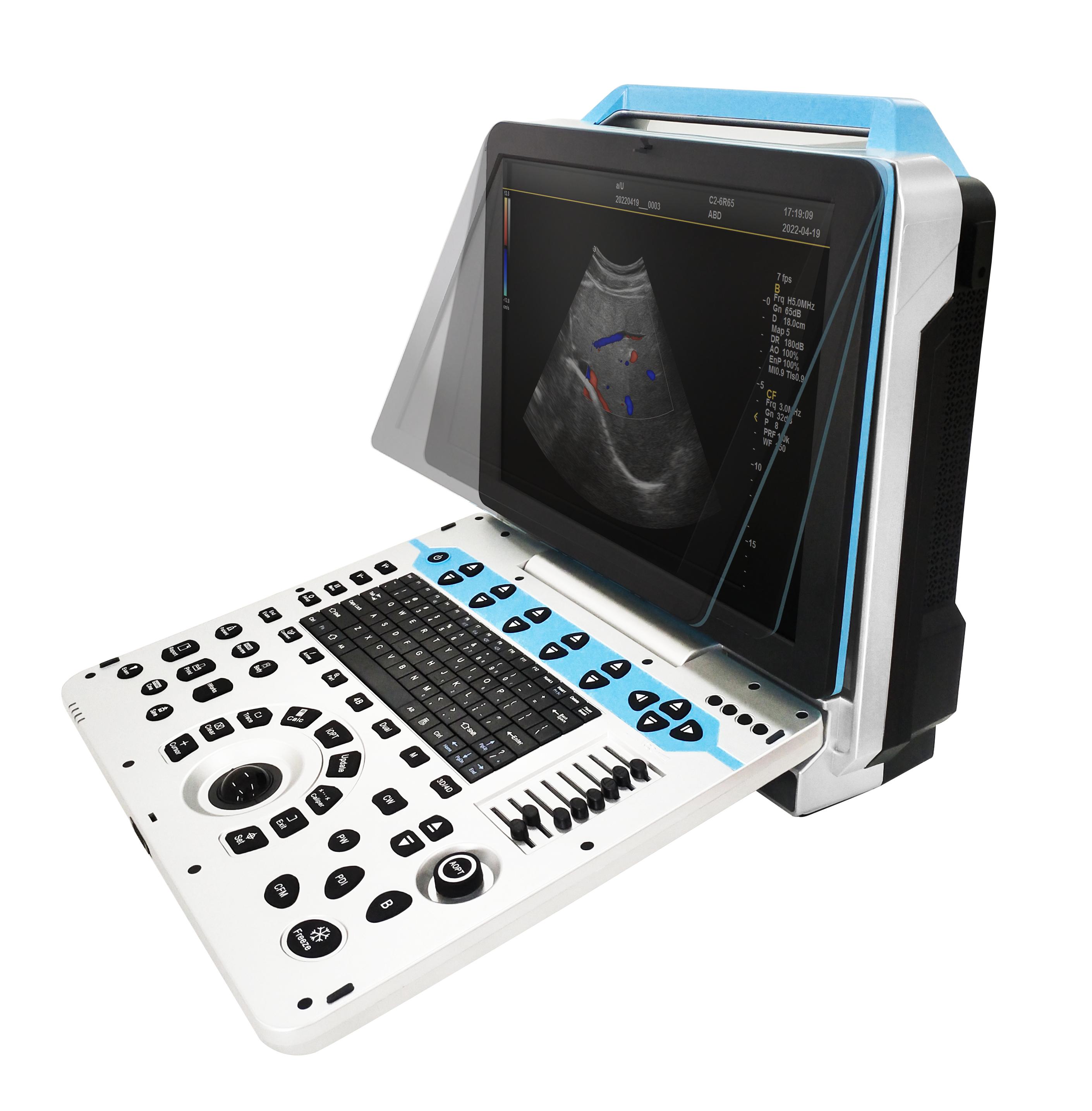 CG-P31 Portable Color Ultrasound System image 2
