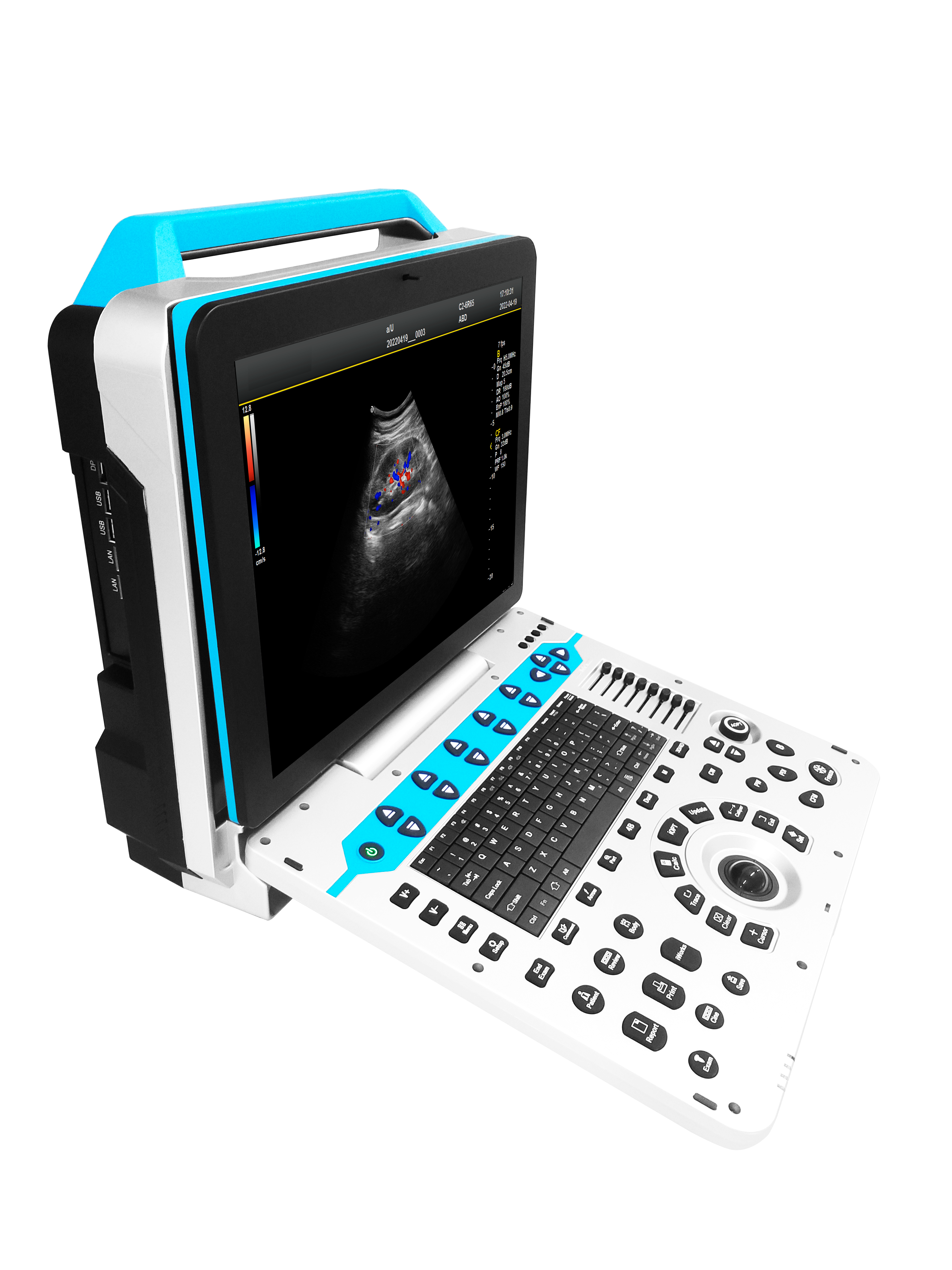 CG-P31 Portable Color Ultrasound System image 3