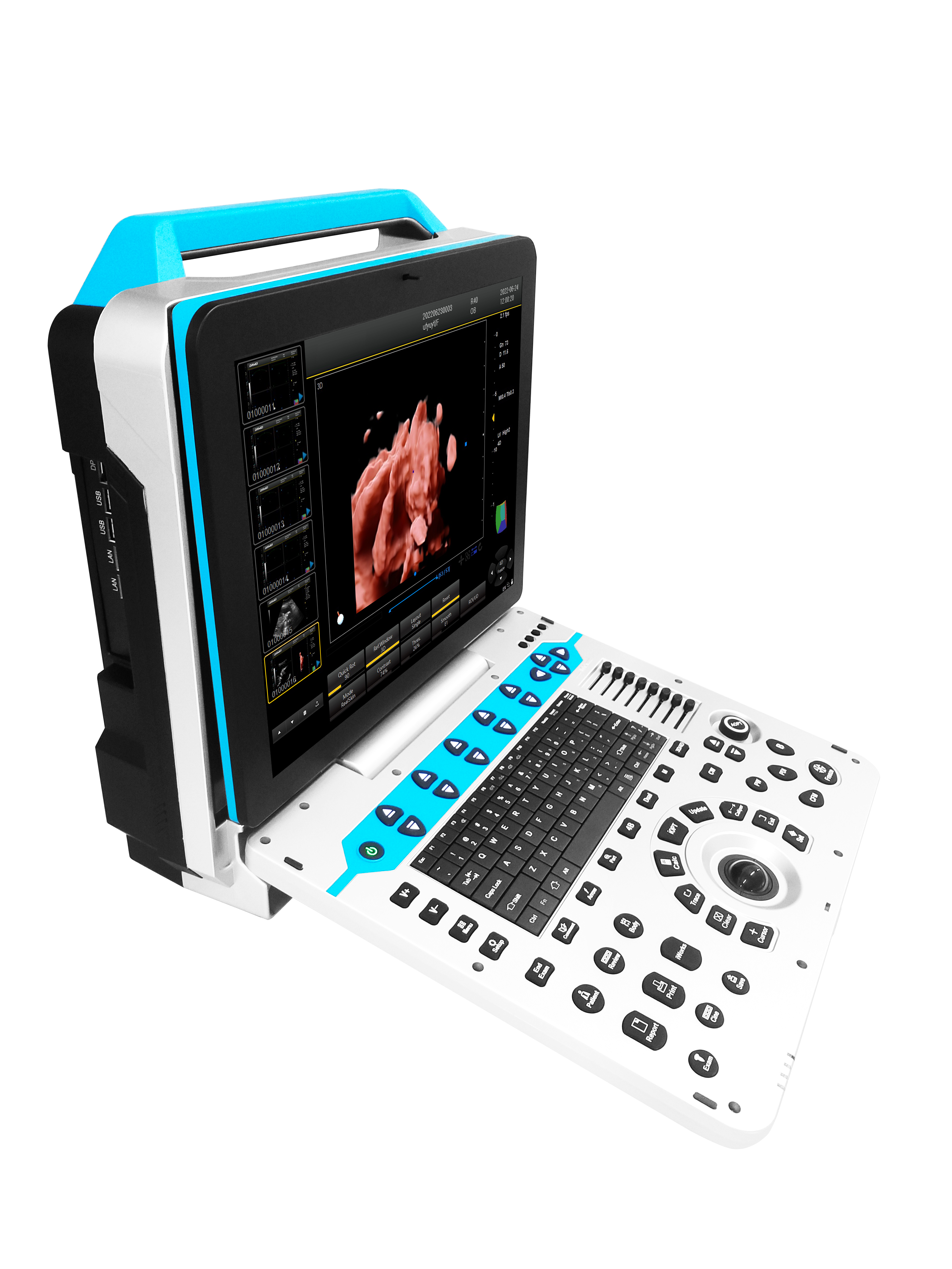 CG-P31 Portable Color Ultrasound System image 4