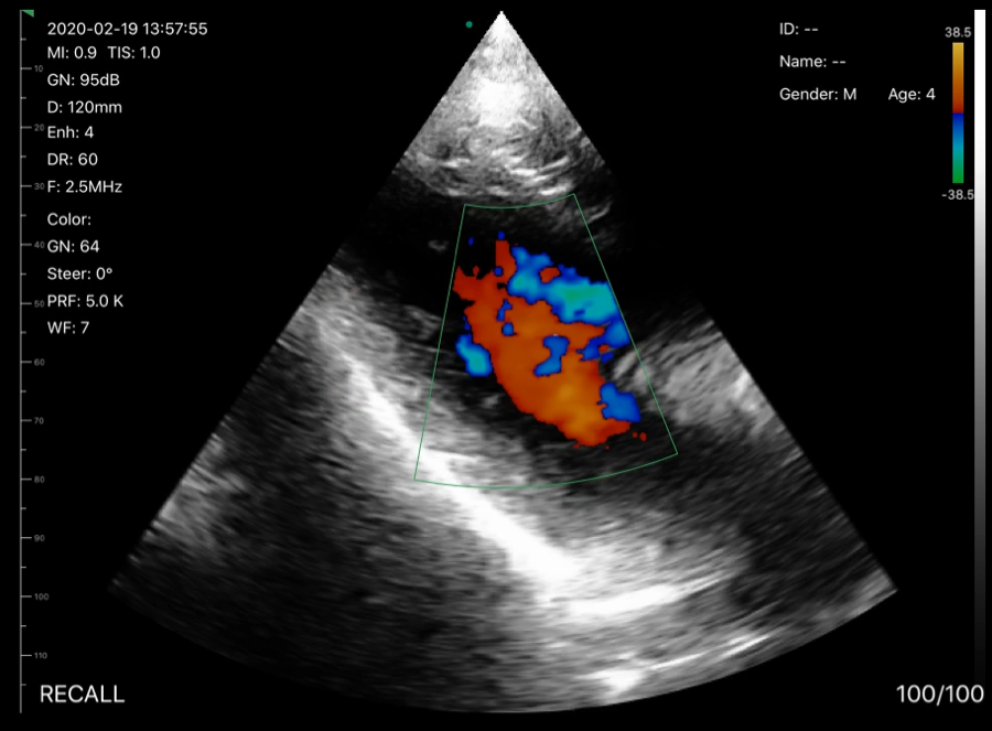 CGU-03 Wireless Handheld Convex & Transvaginal Ultrasound Scanner image 4
