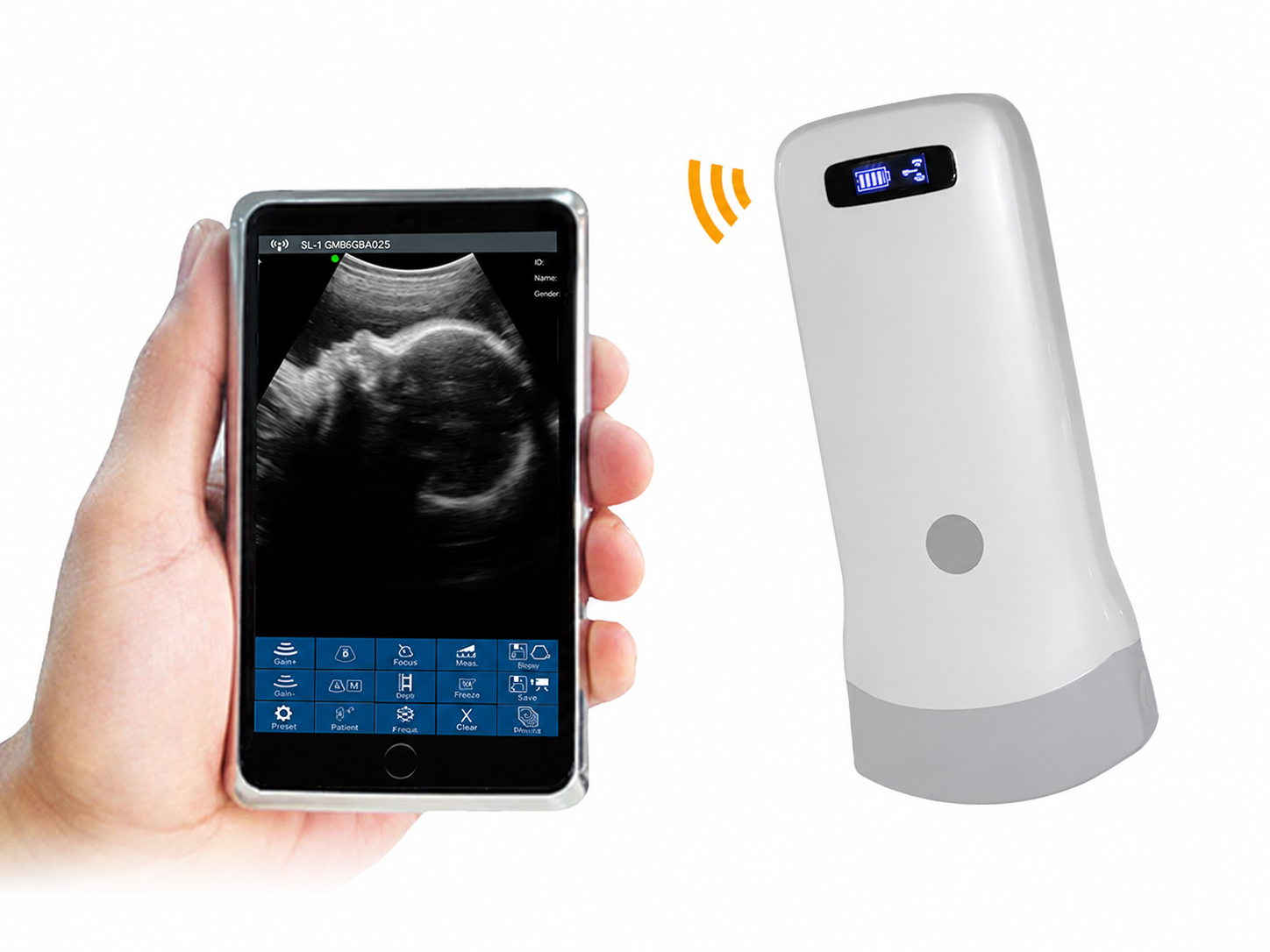 CGU-4P Wireless Handheld Phased Array Ultrasound Scanner