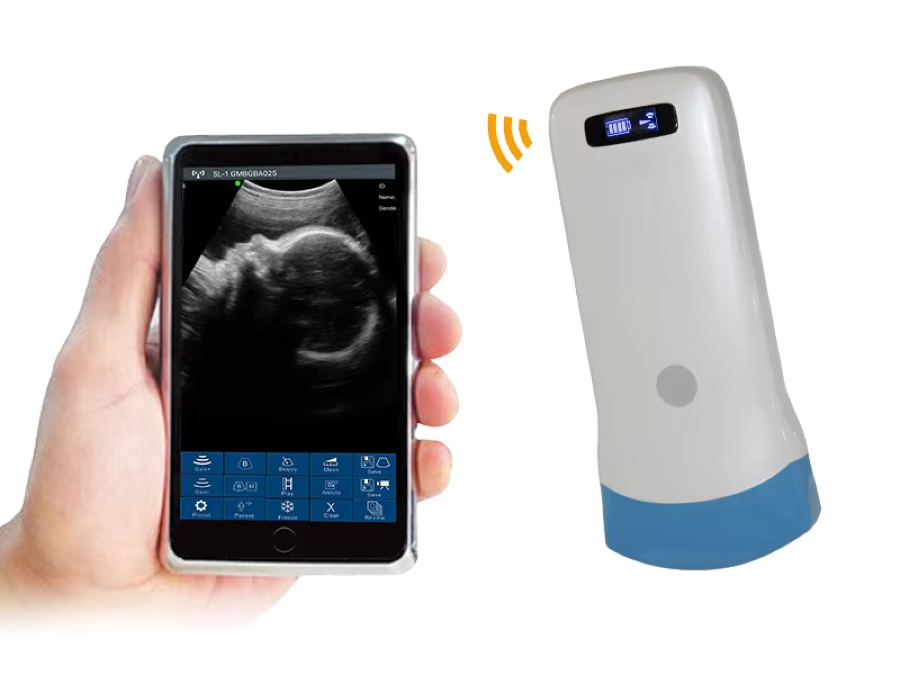 CGU-C Wireless Handheld Convex Ultrasound Scanner