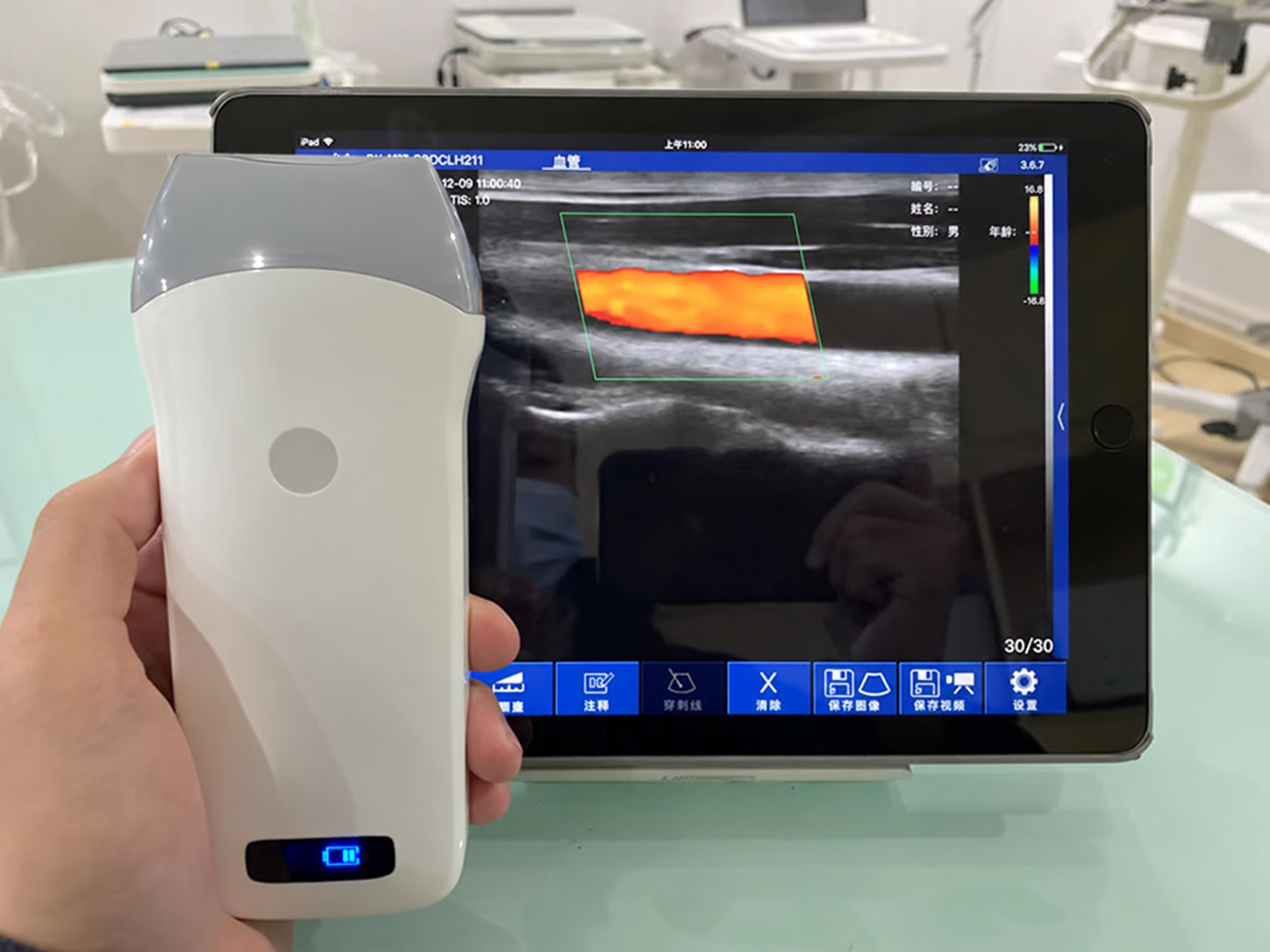 CGU-L Wireless Handheld Linear Ultrasound Scanner