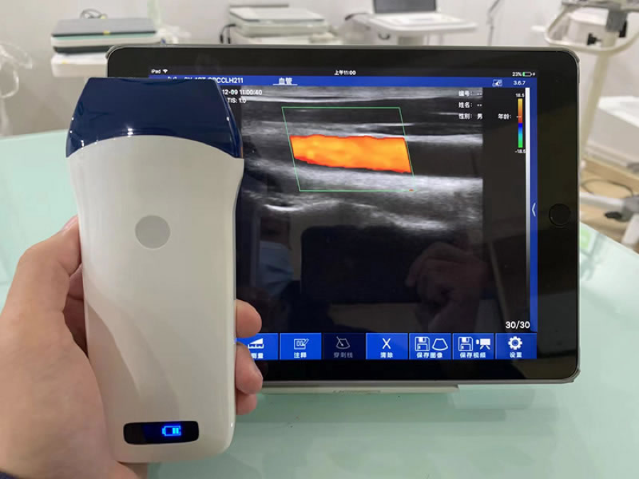 CGU-L Wireless Handheld Linear Ultrasound Scanner image 3