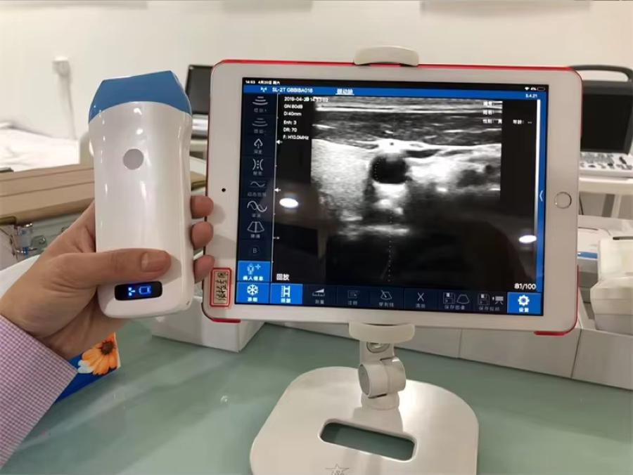 CGU-L Wireless Handheld Linear Ultrasound Scanner image 4