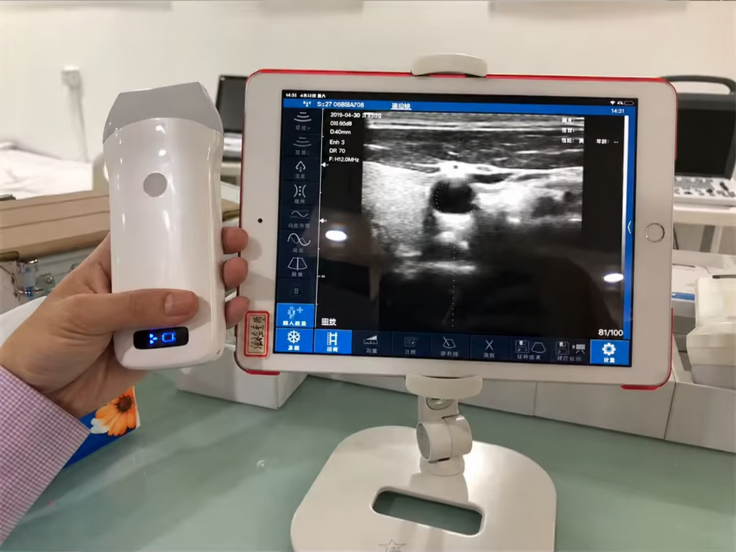 CGU-L Wireless Handheld Linear Ultrasound Scanner image 4
