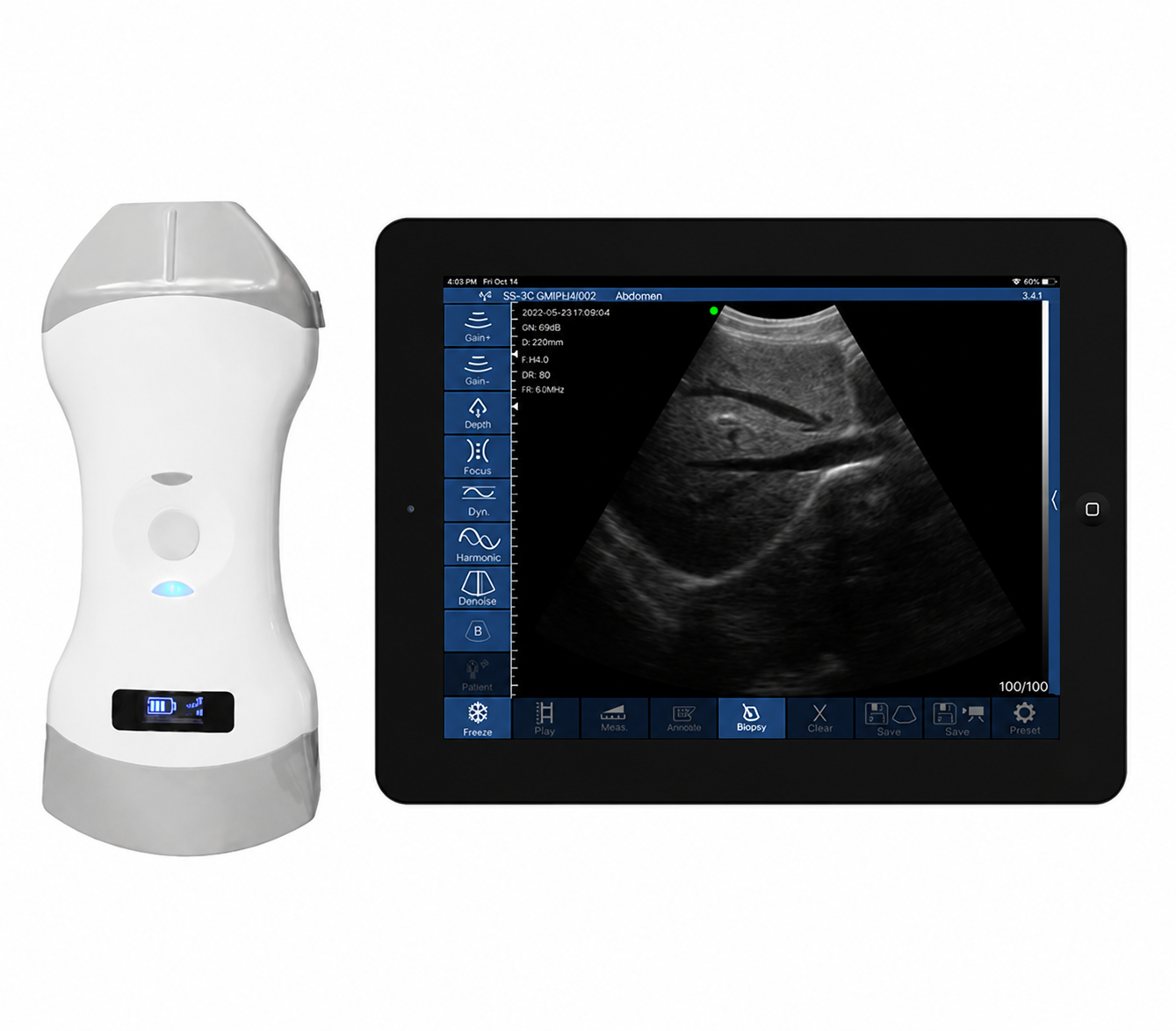 CGU-LC Wireless Convex & Linear Ultrasound Scanner