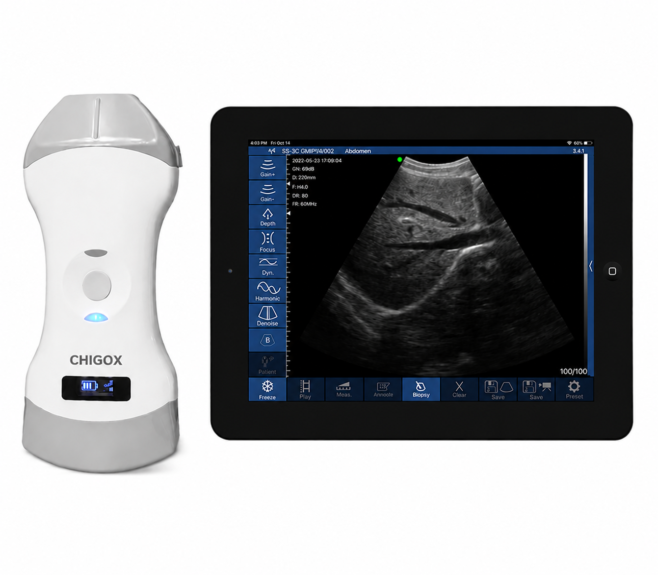 CGU-LCP Wireless 3-in-1 Handheld Ultrasound Scanner