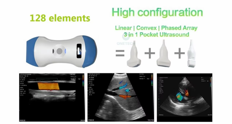 CGU-LCP Wireless 3-in-1 Handheld Ultrasound Scanner