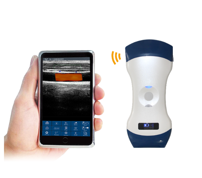 CGU-LCP Wireless 3-in-1 Handheld Ultrasound Scanner image 2